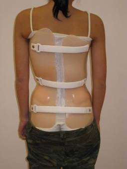 Cranial & spinal orthosis